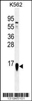 RPS19 Antibody (Center)