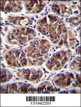 GDF5 Antibody (C-term)