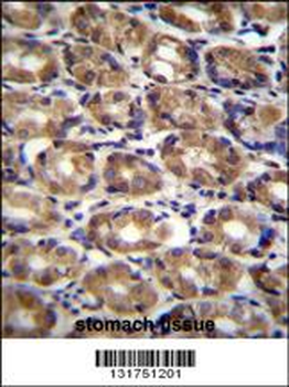 AXIN1 Antibody (C-term)