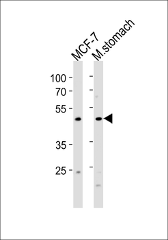 FOXA2 Antibody (C-term)