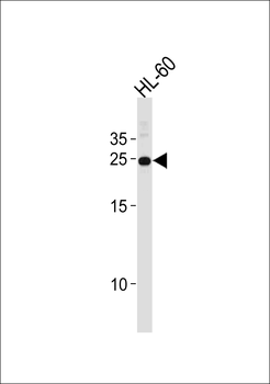HOXA6 Antibody (Center)