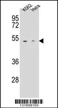 CPB1 Antibody (N-term)