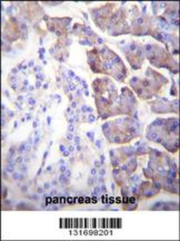 CPB1 Antibody (N-term)