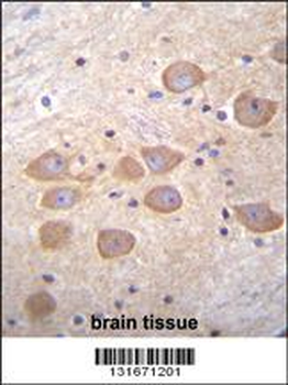 PCDH1 Antibody (N-term)