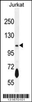 PDE3B Antibody (Center)