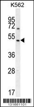 RGS7 Antibody (C-term)