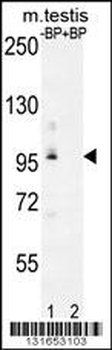PDPR Antibody (C-term)