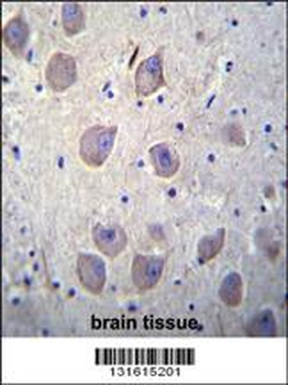 ARRB1 Antibody (C-term)