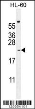 PLA2G2C Antibody (C-term)