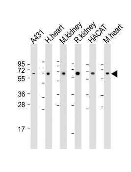 OTOP1 Antibody (Center)
