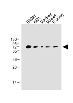 OTOP1 Antibody (Center)