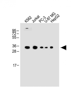 PPP1R3G Antibody (C-term)