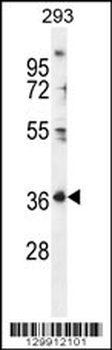FOLR4 Antibody (N-term)
