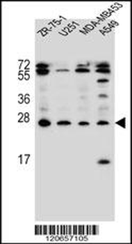 EDN1 Antibody (C-term)