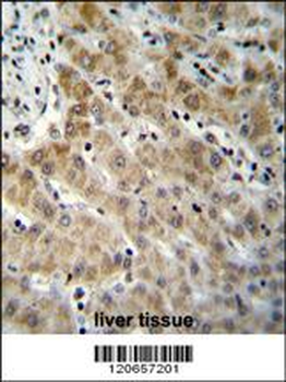 EDN1 Antibody (C-term)