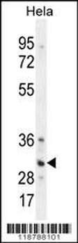TRADD Antibody (Center)