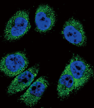 POSTN Antibody (C-term)