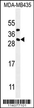CD8B1 Antibody (C-term)