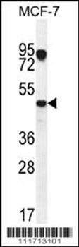 VEGF3 Antibody (N-term)