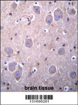 RAP1GDS1 Antibody (Center)
