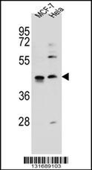 ZNF384 Antibody (C-term)