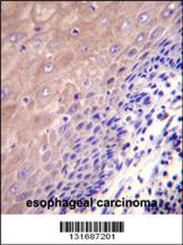 GCLC Antibody (N-term)