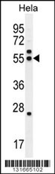 TBB8B Antibody (C-term)