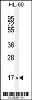 C1QC Antibody (Center)