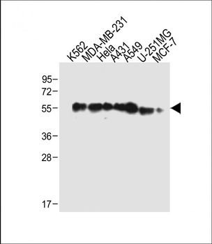 TUBB6 Antibody (Center)