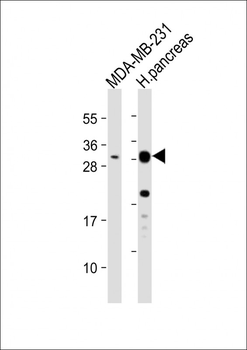 PRSS3 Antibody (Center)