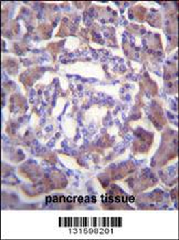 PRSS3 Antibody (Center)