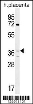OR2AT4 Antibody (C-term)