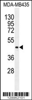LIPK Antibody (C-term)