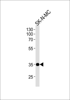 NKX1-1 Antibody (Center)