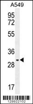PABPN1L Antibody (Center)