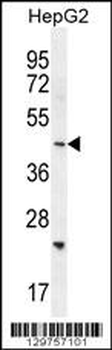 SH2D4B Antibody (C-term)