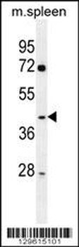 NFKBID Antibody (N-term)