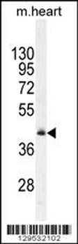 RMD1 Antibody (N-term)