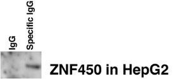 ZBT24 Antibody (N-term)