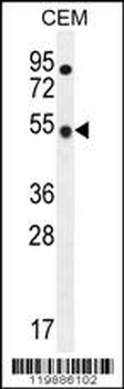 TBC1D13 Antibody (Center)
