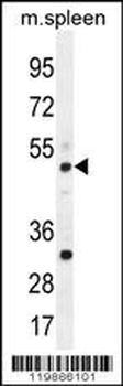 TBC1D13 Antibody (Center)