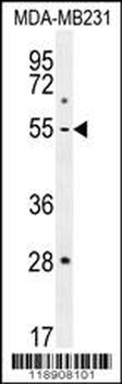 MMP1 Antibody (Center)