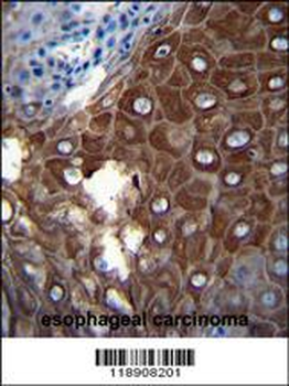 MMP1 Antibody (Center)