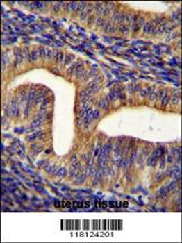 GHSR Antibody (C-term)