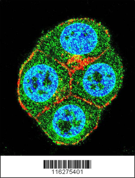 BTRC Antibody (N-term)