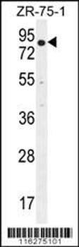 BTRC Antibody (N-term)