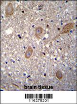 BTRC Antibody (N-term)