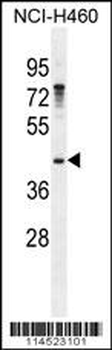 GAS1 Antibody (N-term)