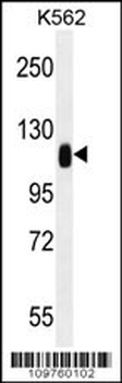 TRIM28 Antibody (N-term)