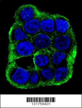 CLCN7 Antibody (C-term)
